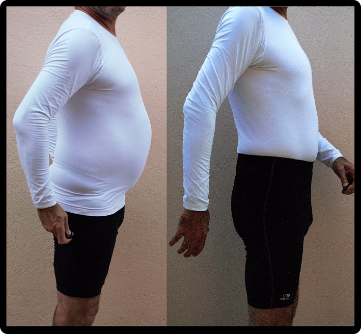 antes/depois